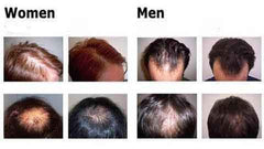 Organic Hair Growth Spray